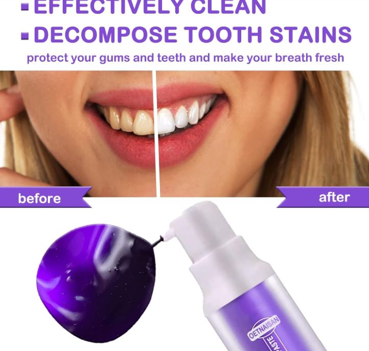 LumiSmile Purple™:🌟 ¡Transforma tu sonrisa en días con el poder del morado!😁🦷