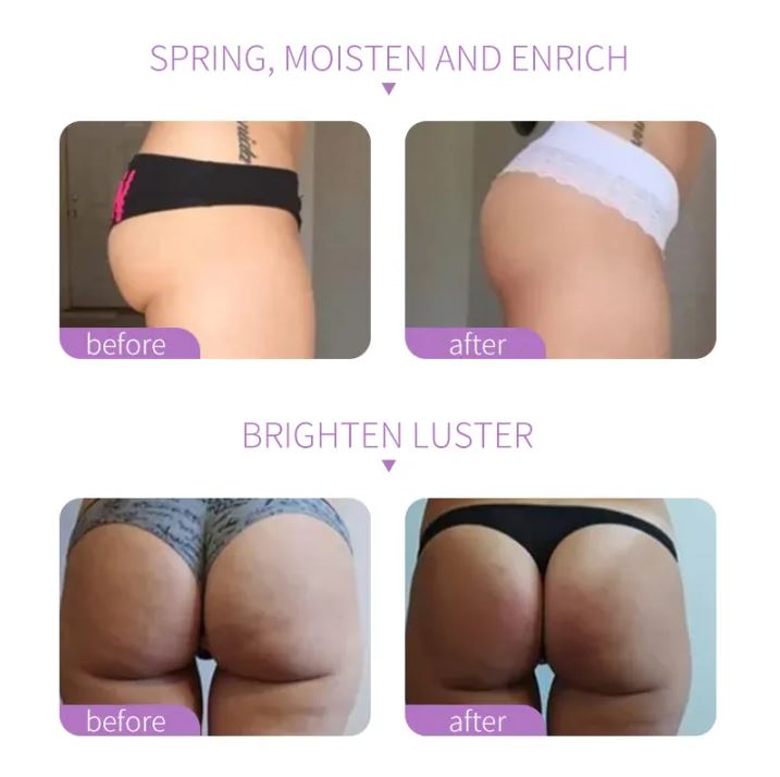 GlowHip™:¡Levanta, reafirma y da volumen a tus glúteos de forma natural!🍑