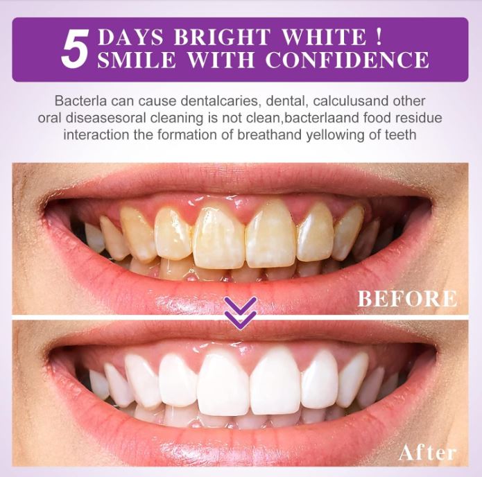 LumiSmile Purple™:🌟 ¡Transforma tu sonrisa en días con el poder del morado!😁🦷