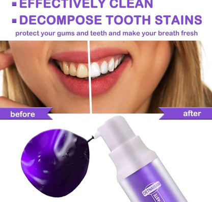 LumiSmile Purple™:🌟 ¡Transforma tu sonrisa en días con el poder del morado!😁🦷