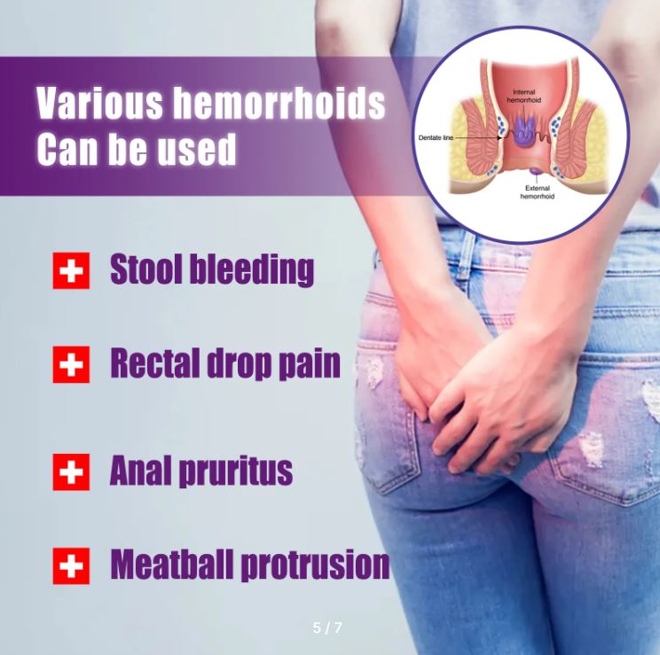 Hemofresh Spray: ¿Dolor al Sentarse?  Solución Natural, Devuelve la Comodidad