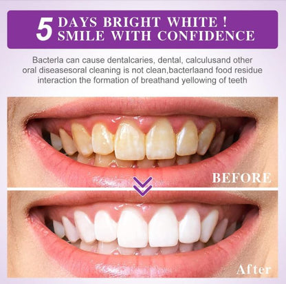 LumiSmile Purple™:🌟 ¡Transforma tu sonrisa en días con el poder del morado!😁🦷